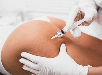 Tratamento Intradermo para Aumento Massa Magra