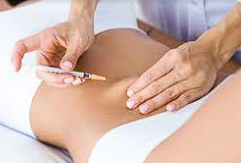 Tratamento Intradermo para Emagrecimento