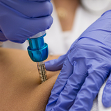 Tratamento Intradermo para Ansiedade por Doces