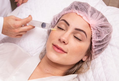 Ozonioterapia Facial