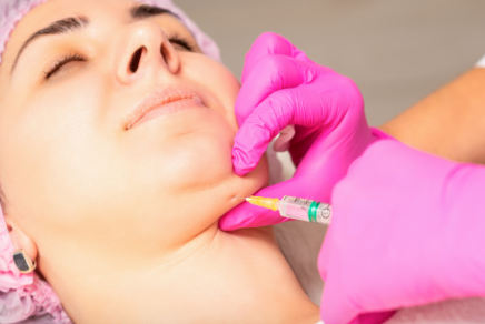 Lipo Enzimática de Papada