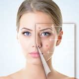 Tratamento de Verrugas com Laser (BLAUMAN)